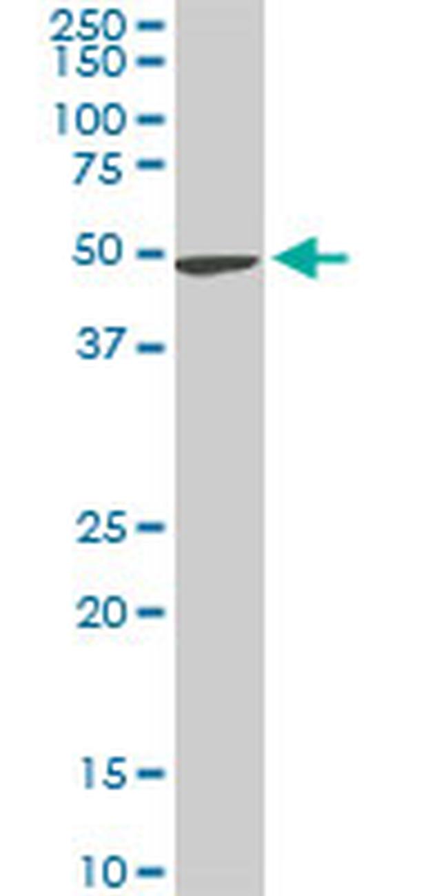 NEK2 Antibody in Western Blot (WB)