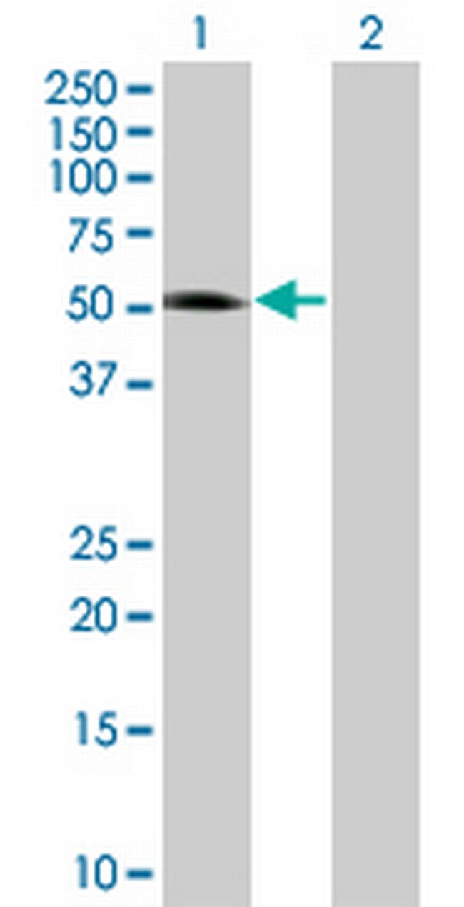 NEUROD1 Antibody in Western Blot (WB)