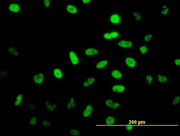 NEUROD1 Antibody in Immunocytochemistry (ICC/IF)