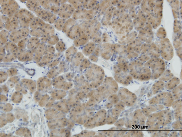 NEUROD1 Antibody in Immunohistochemistry (Paraffin) (IHC (P))