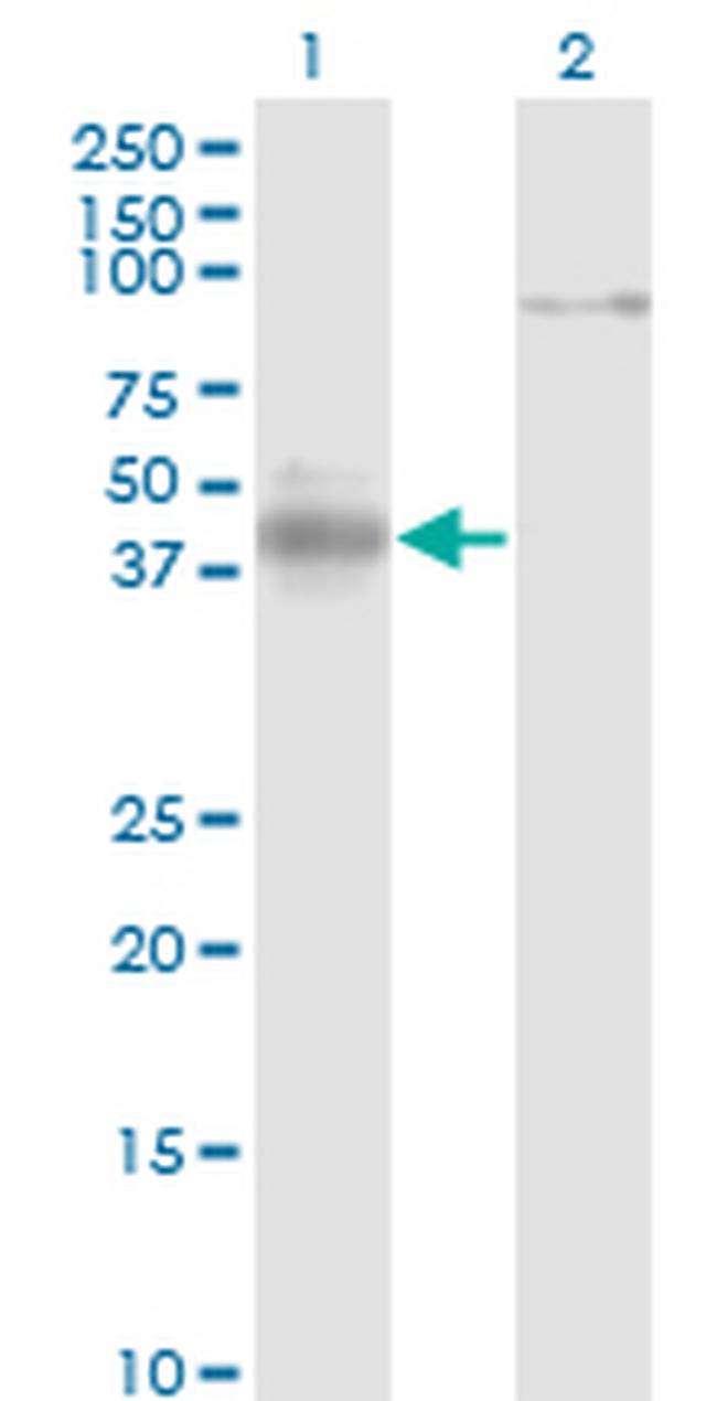 NEUROD1 Antibody in Western Blot (WB)