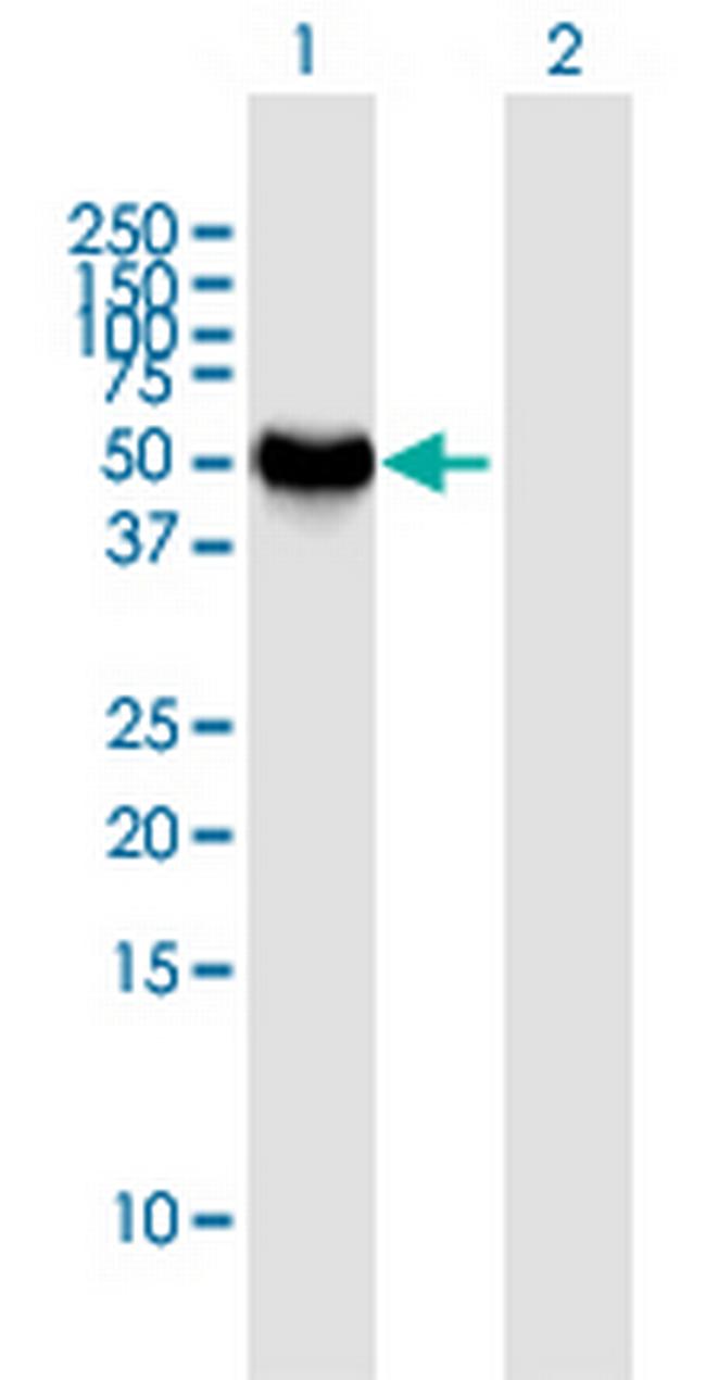 NEUROD2 Antibody in Western Blot (WB)