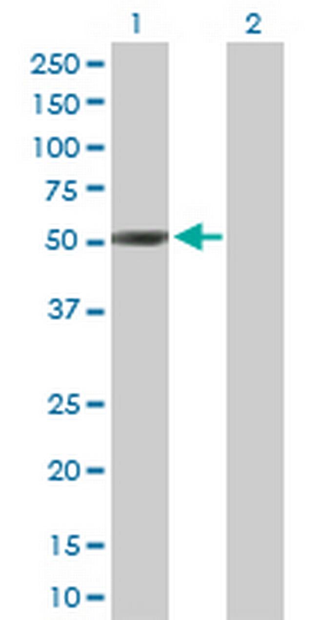 NEUROD2 Antibody in Western Blot (WB)