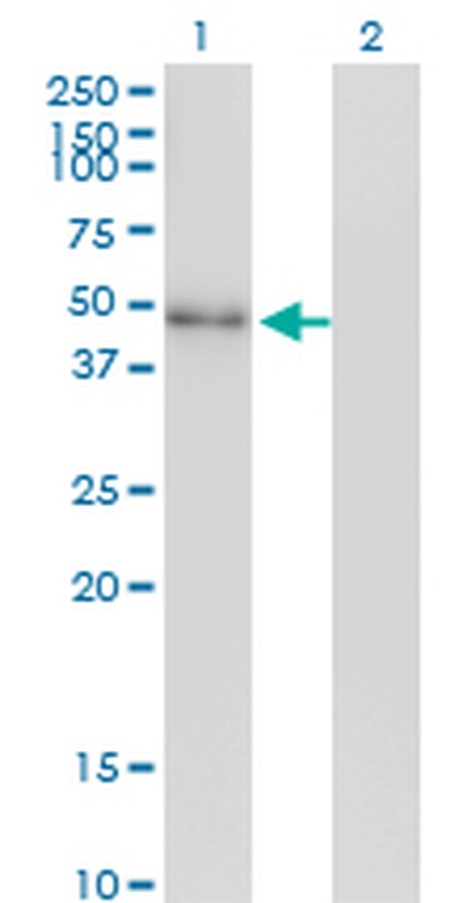 NEUROD2 Antibody in Western Blot (WB)