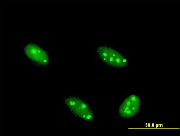 NFIA Antibody in Immunocytochemistry (ICC/IF)