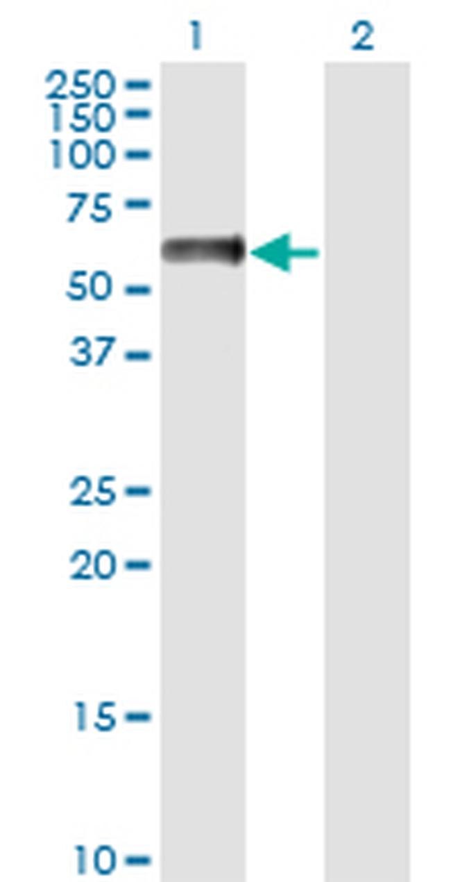 NFIA Antibody in Western Blot (WB)