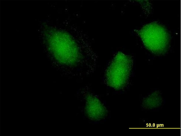 NFATC3 Antibody in Immunocytochemistry (ICC/IF)