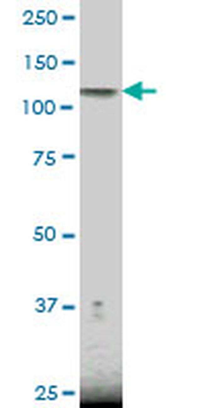 NFKB1 Antibody in Western Blot (WB)