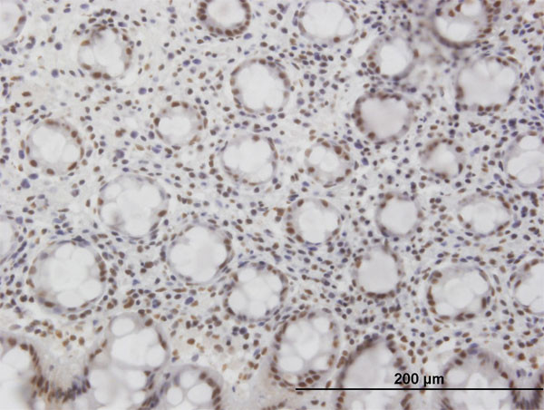 NFKB1 Antibody in Immunohistochemistry (Paraffin) (IHC (P))