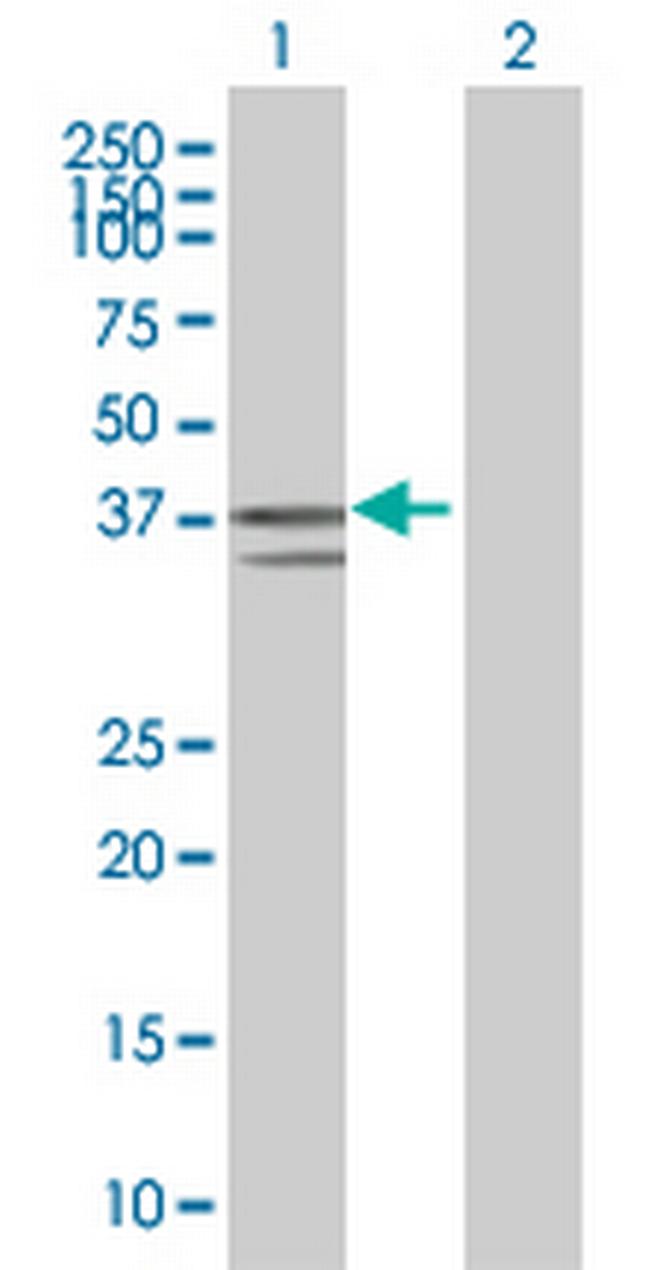 NFKBIB Antibody in Western Blot (WB)