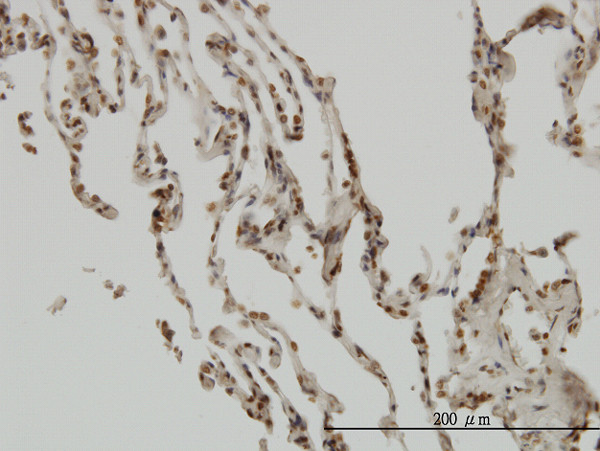 NFKBIB Antibody in Immunohistochemistry (Paraffin) (IHC (P))