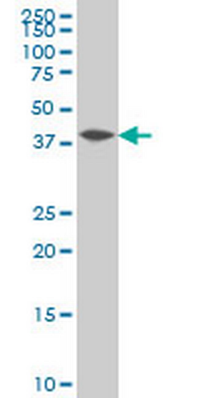 NFKBIB Antibody in Western Blot (WB)