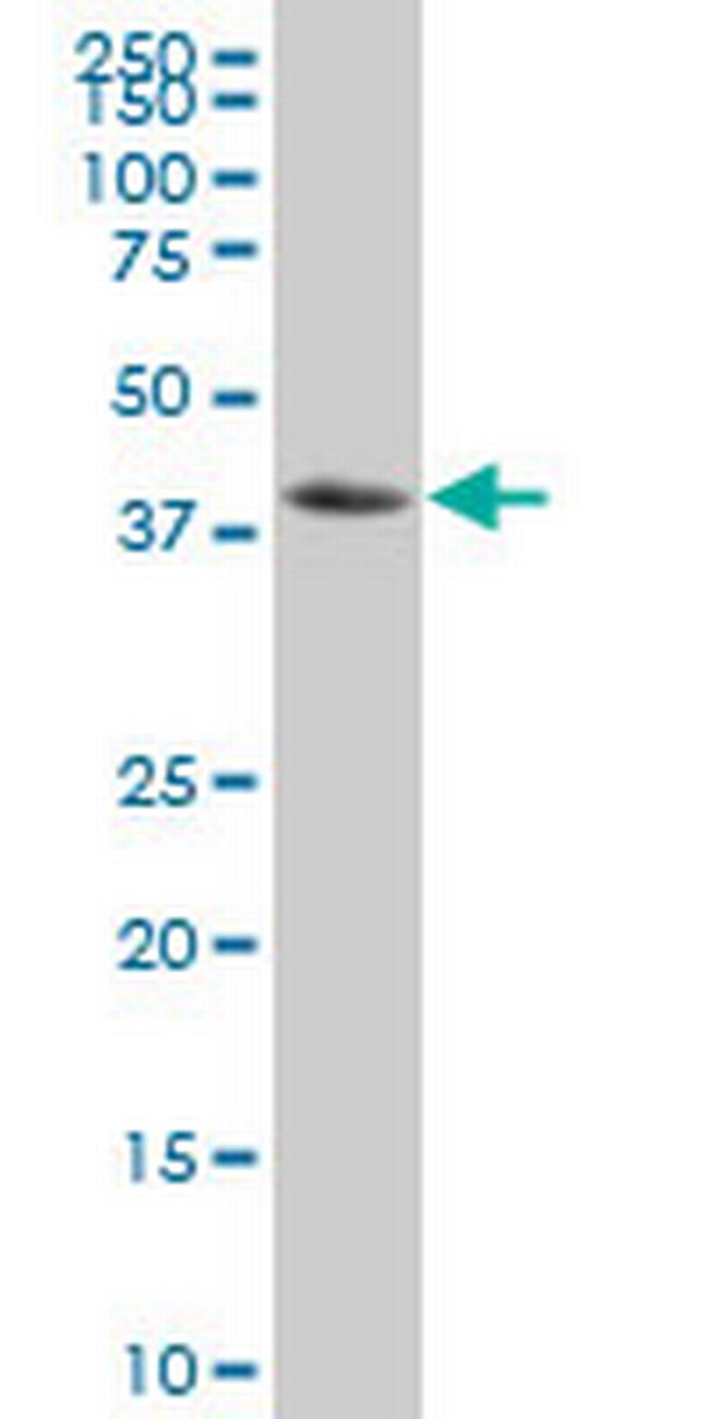 NFKBIB Antibody in Western Blot (WB)