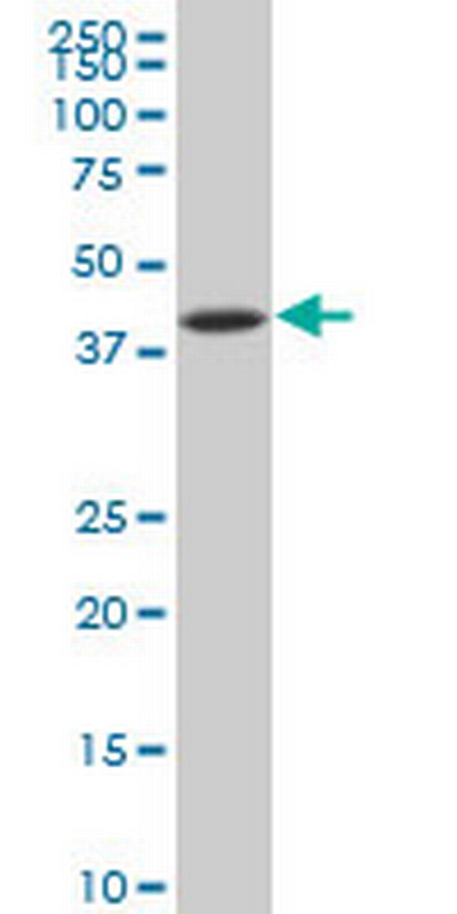 NFKBIB Antibody in Western Blot (WB)