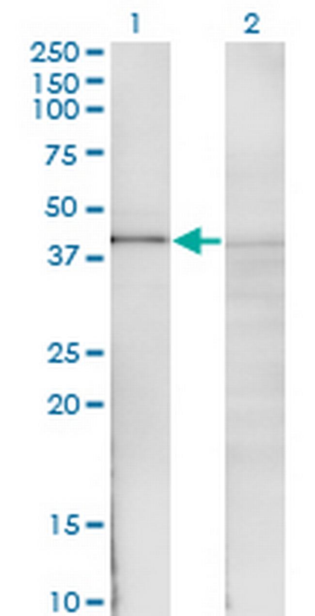 NFKBIB Antibody in Western Blot (WB)