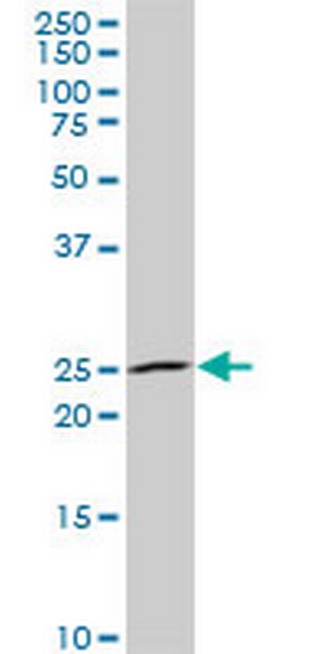 NKX3-1 Antibody in Western Blot (WB)