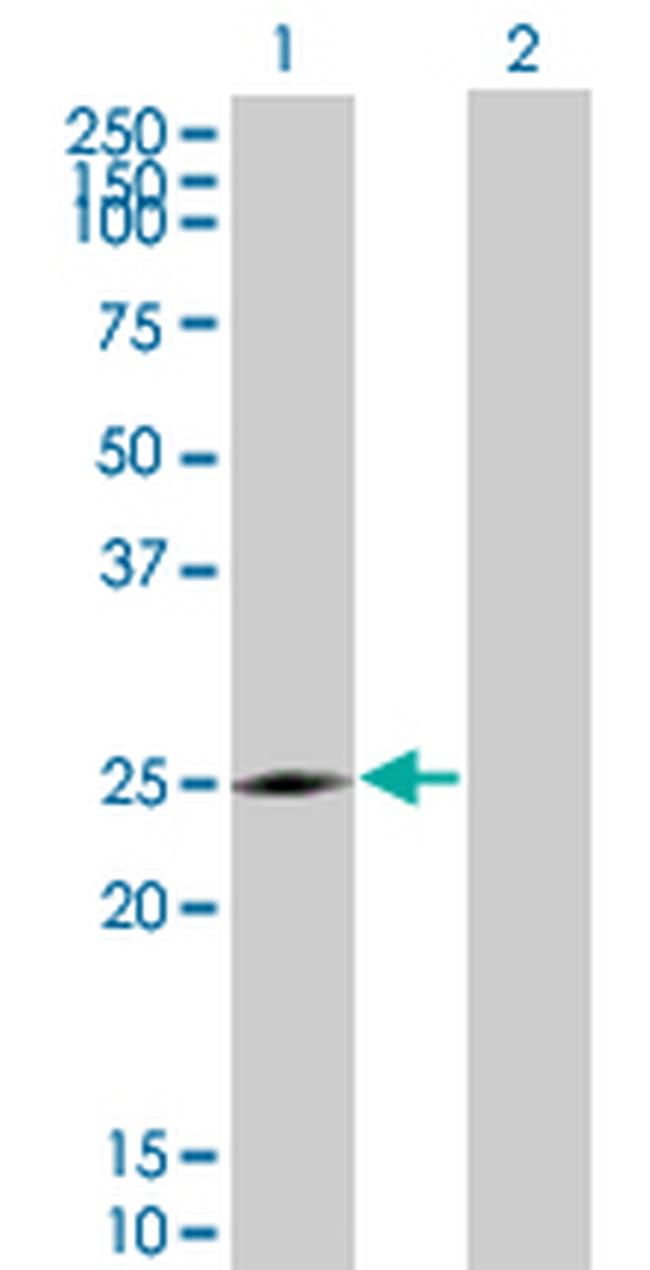 NQO2 Antibody in Western Blot (WB)