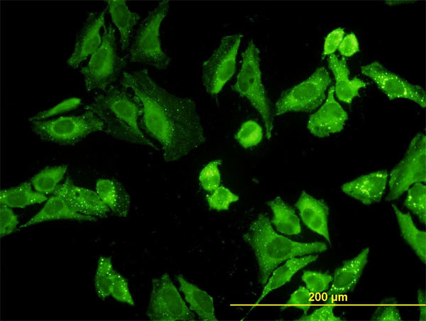 NODAL Antibody in Immunocytochemistry (ICC/IF)