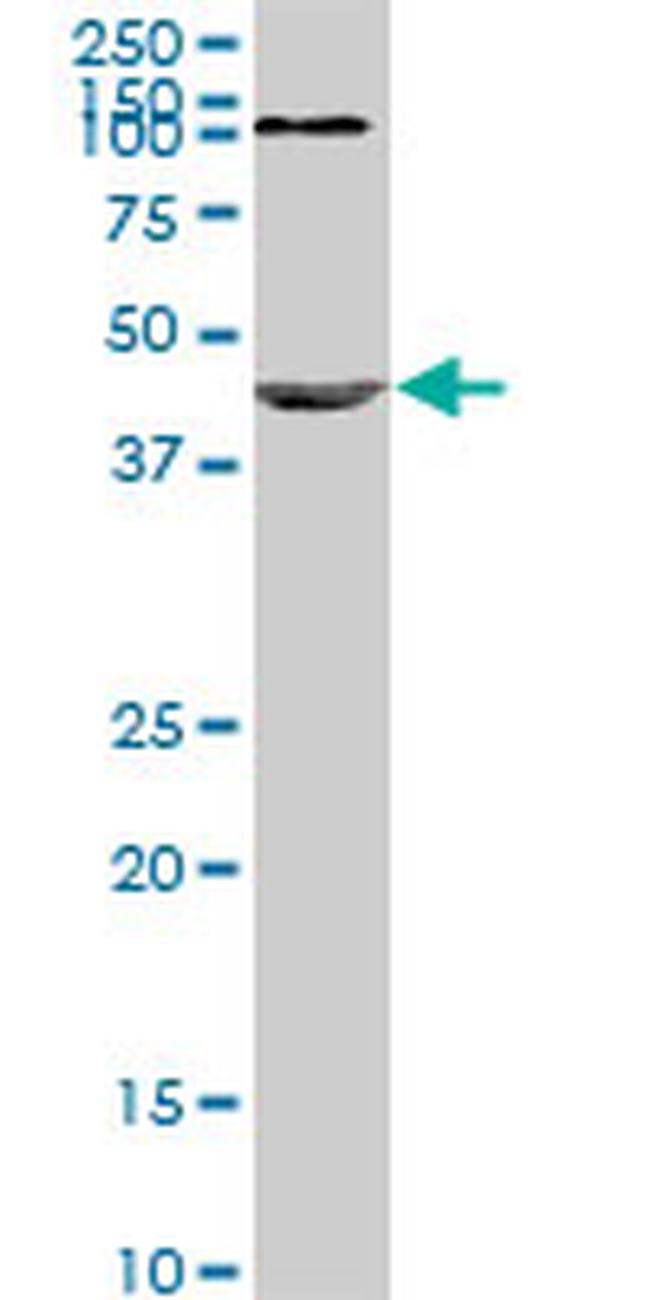 NODAL Antibody in Western Blot (WB)