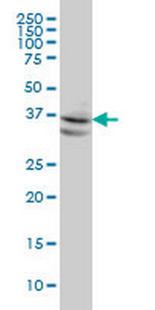 NODAL Antibody in Western Blot (WB)