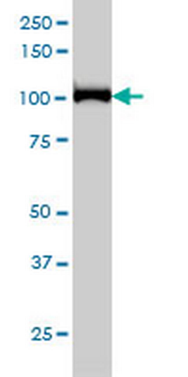 CNOT3 Antibody in Western Blot (WB)