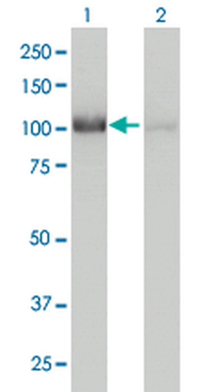 CNOT3 Antibody in Western Blot (WB)