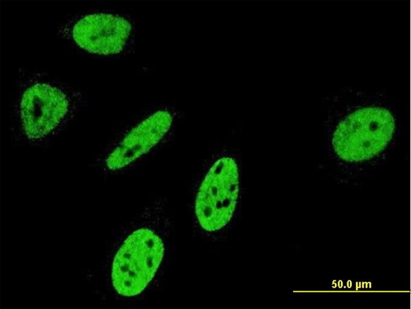 NOTCH3 Antibody in Immunocytochemistry (ICC/IF)