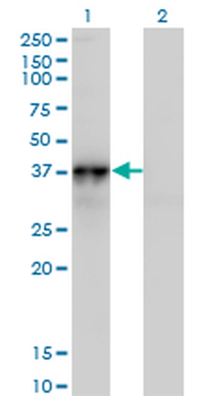 NOV Antibody in Western Blot (WB)