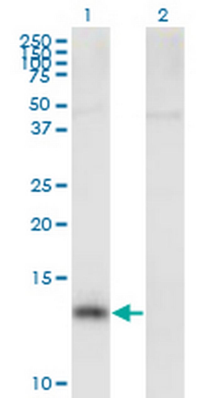 NPHP1 Antibody in Western Blot (WB)