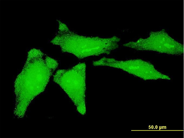 YBX1 Antibody in Immunocytochemistry (ICC/IF)