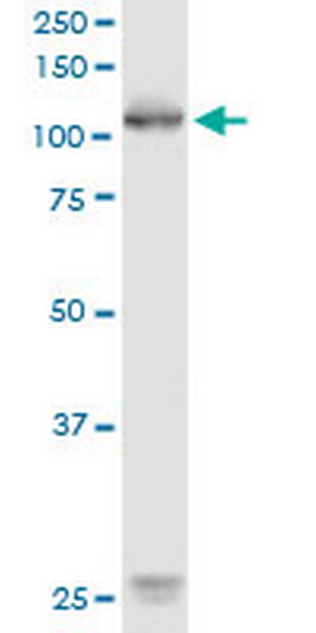 ROR1 Antibody in Western Blot (WB)