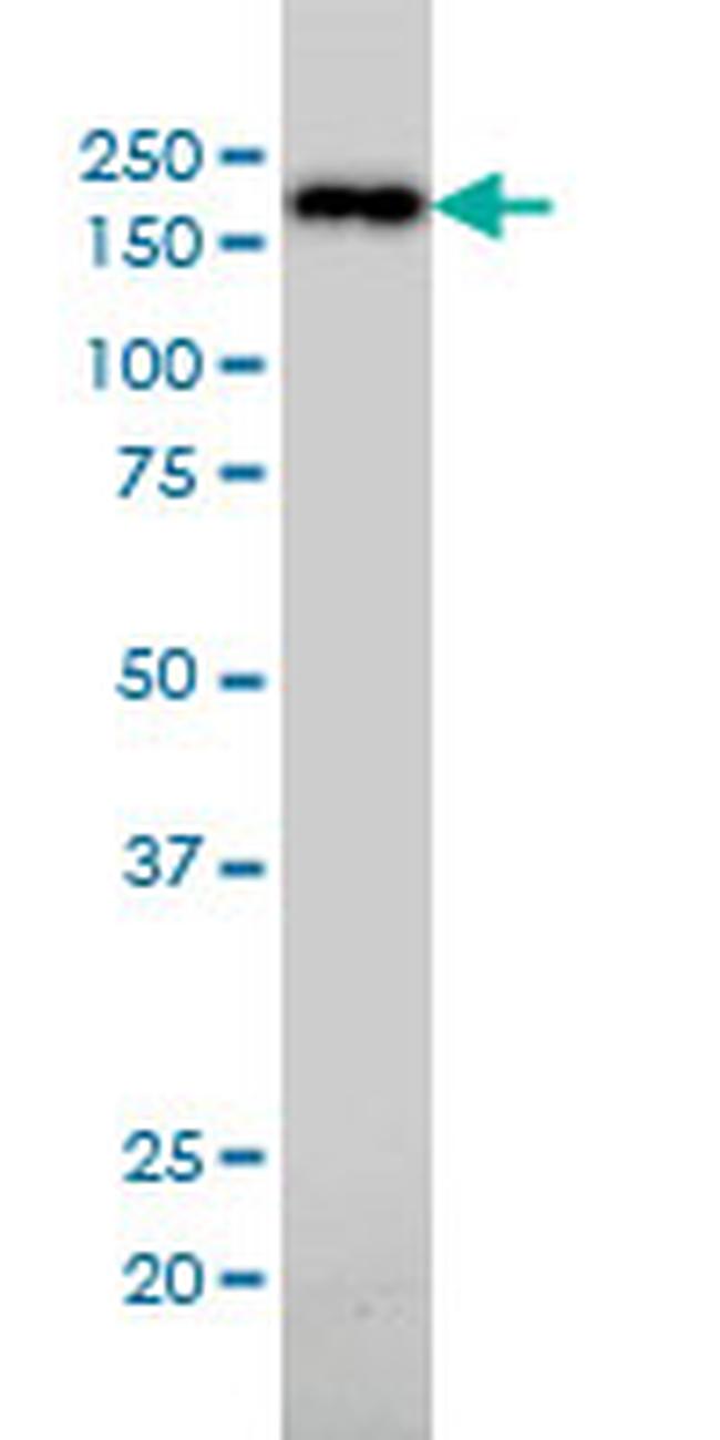 NUMA1 Antibody in Western Blot (WB)