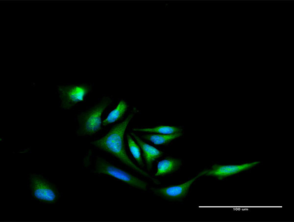 NR4A2 Antibody in Immunocytochemistry (ICC/IF)