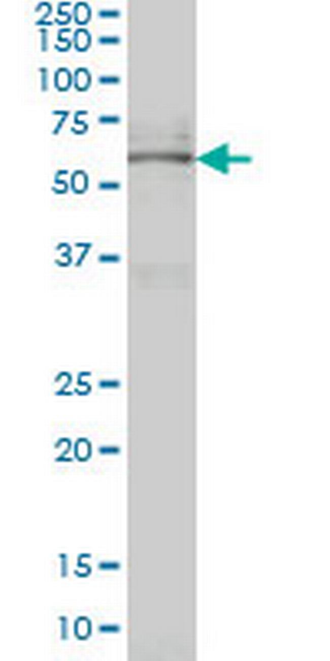 NR4A2 Antibody in Western Blot (WB)