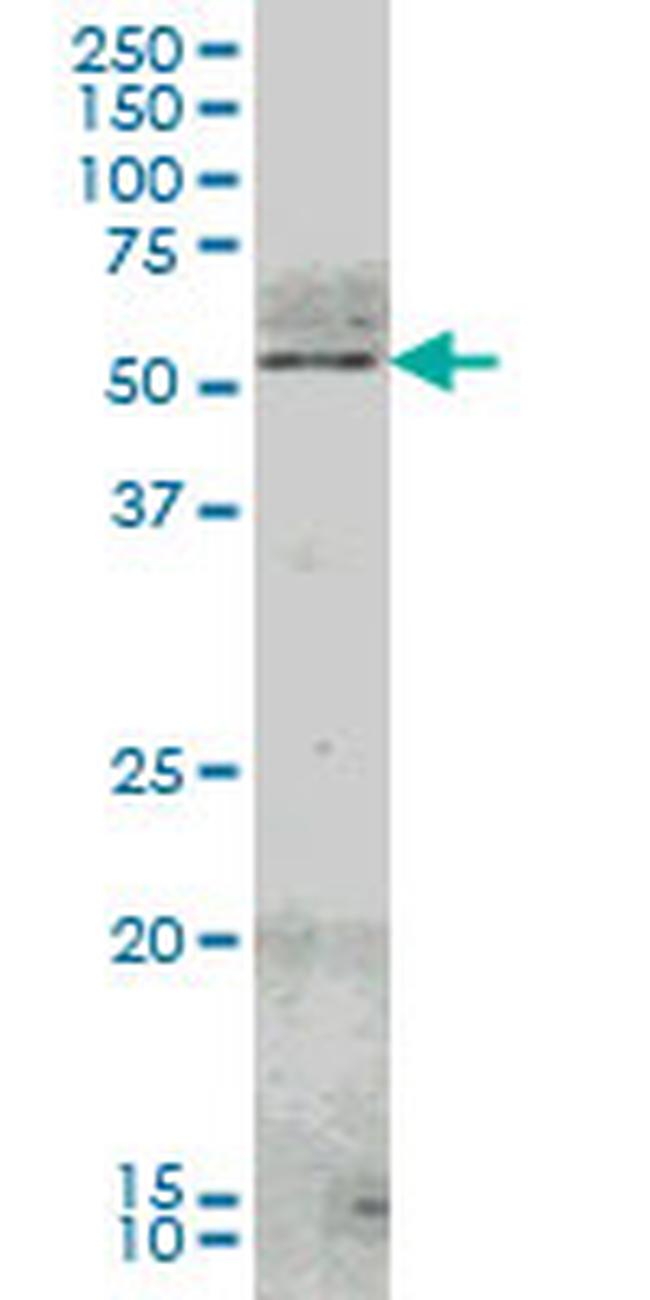 NR4A2 Antibody in Western Blot (WB)