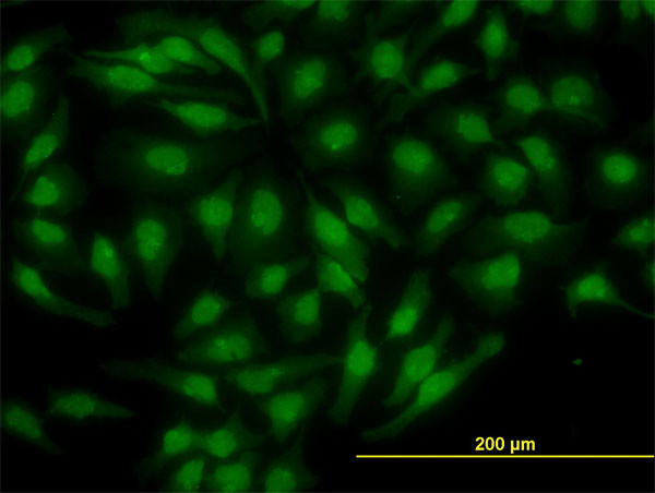 NR4A2 Antibody in Immunocytochemistry (ICC/IF)