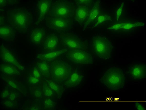 NR4A2 Antibody in Immunocytochemistry (ICC/IF)