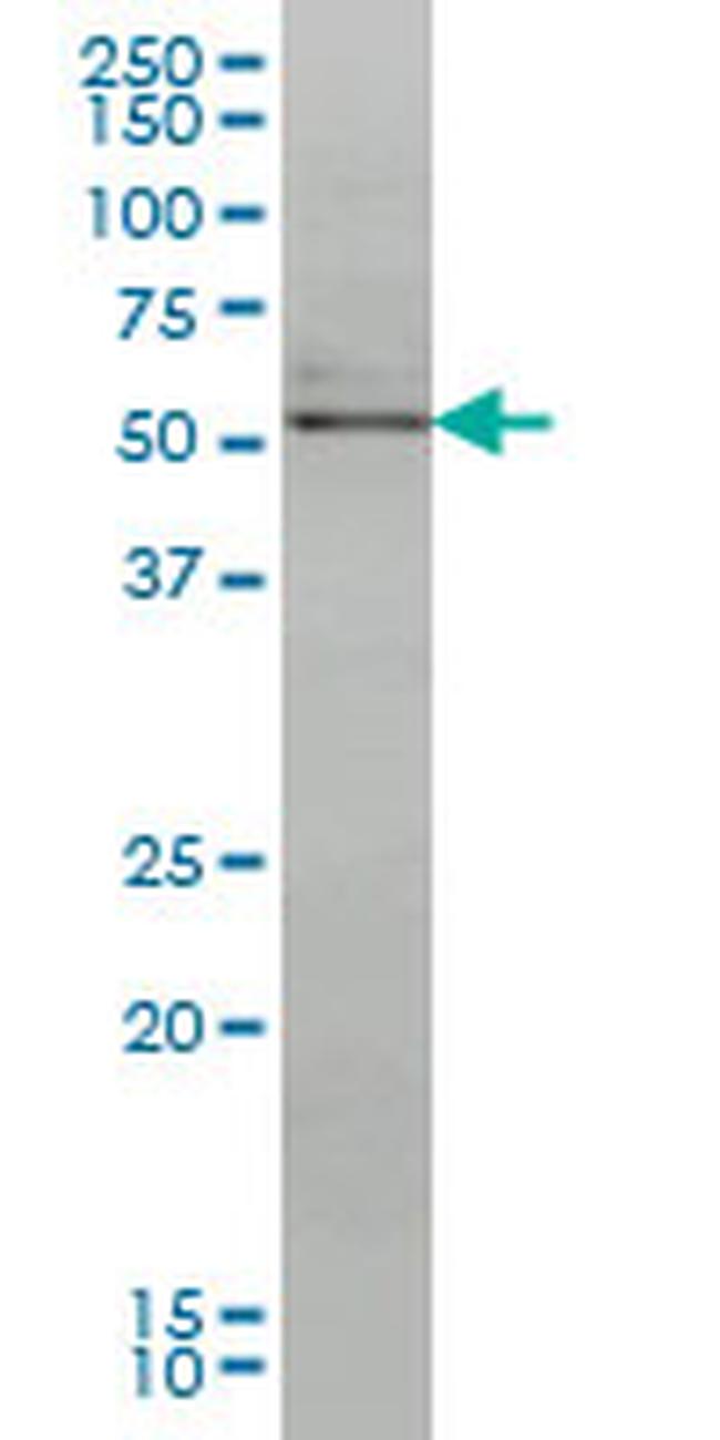 NR4A2 Antibody in Western Blot (WB)