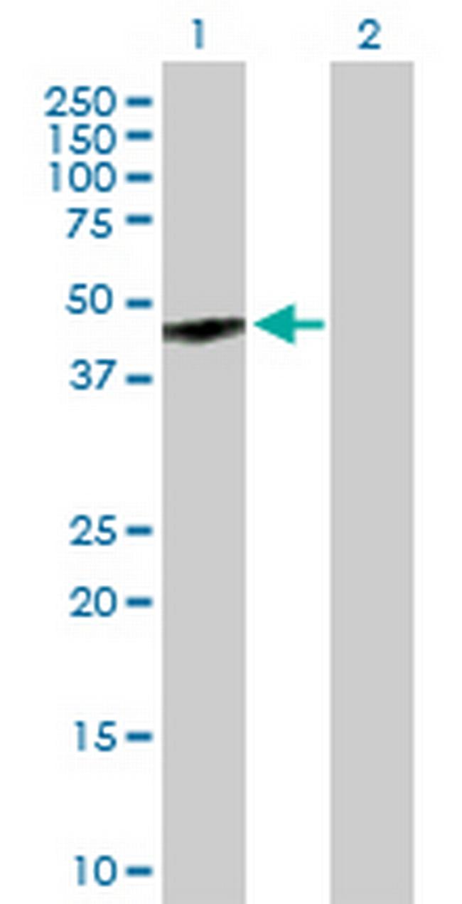 GPR143 Antibody in Western Blot (WB)