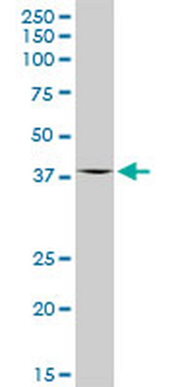 OAS1 Antibody in Western Blot (WB)