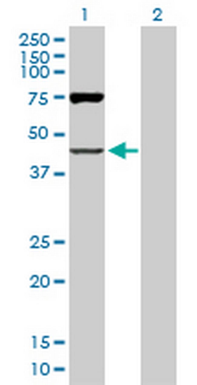 OAS1 Antibody in Western Blot (WB)