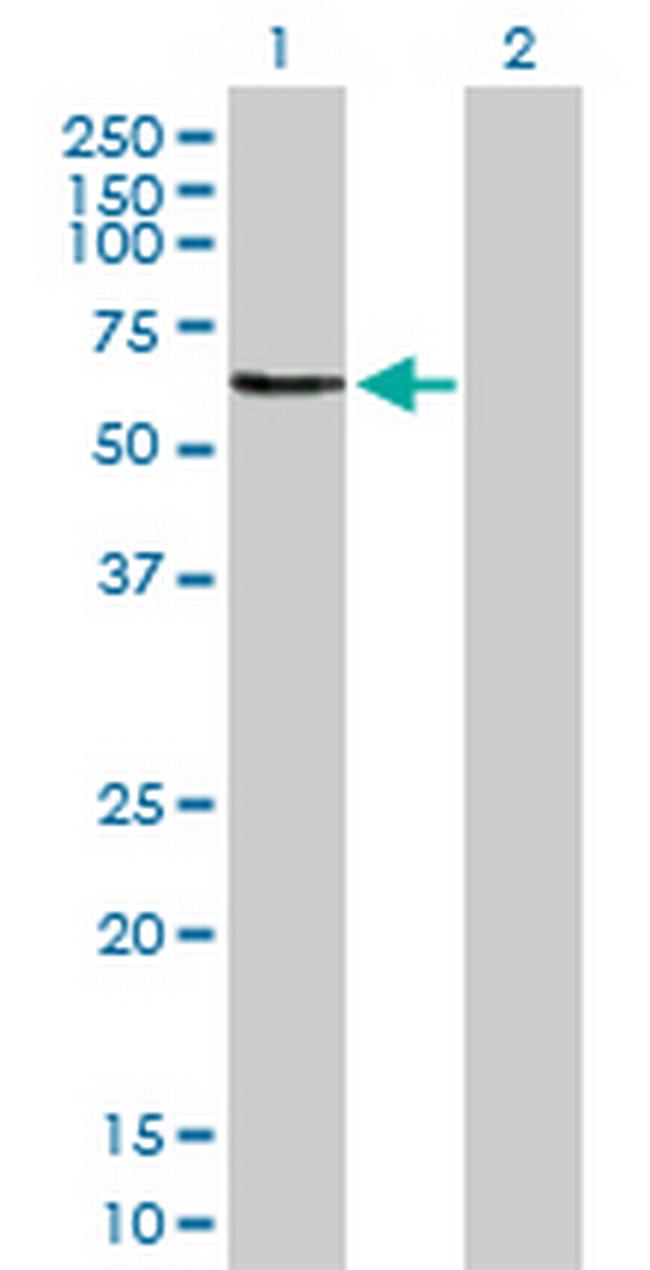 OMD Antibody in Western Blot (WB)