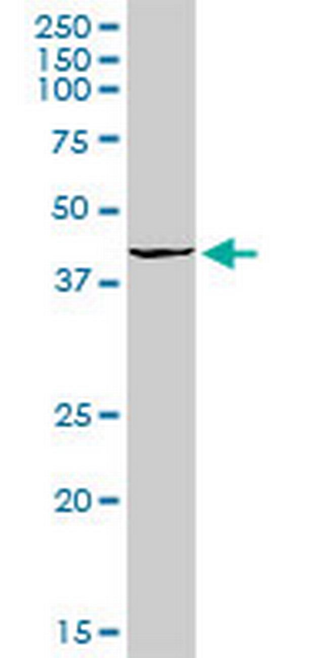 OGG1 Antibody in Western Blot (WB)