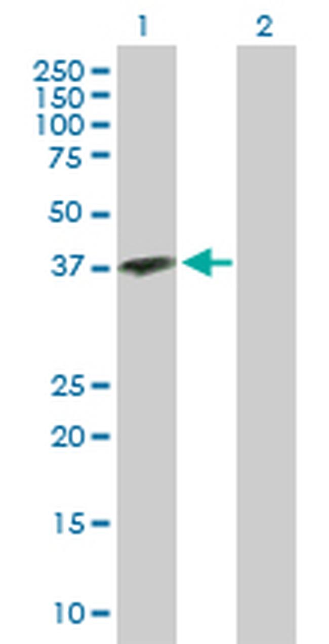 OGN Antibody in Western Blot (WB)