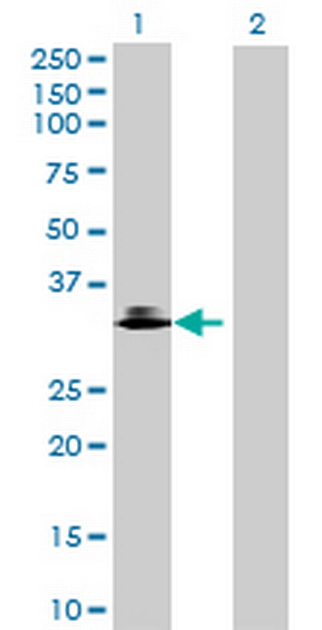 OLR1 Antibody in Western Blot (WB)