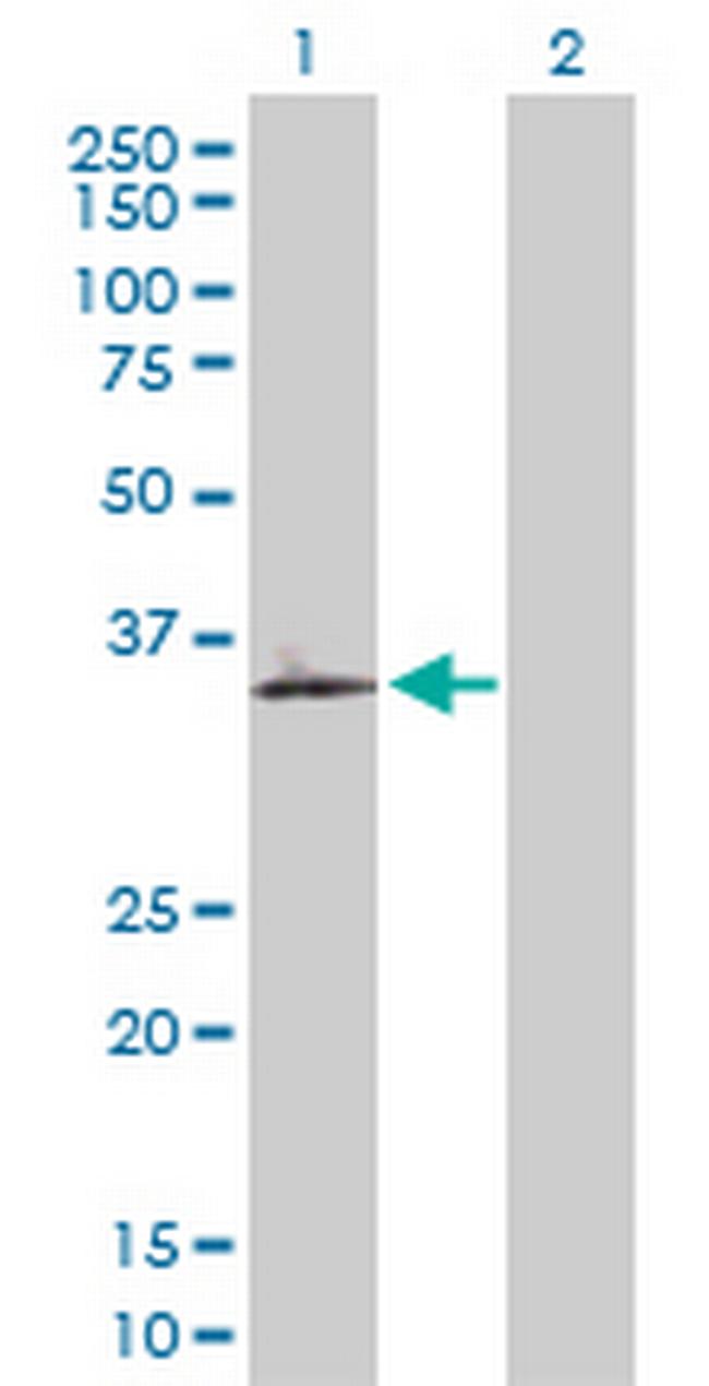 OLR1 Antibody in Western Blot (WB)