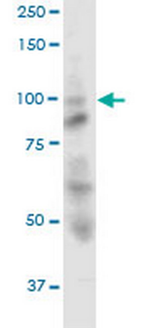 OPA1 Antibody in Western Blot (WB)