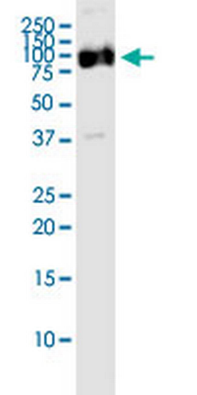 OPA1 Antibody in Western Blot (WB)