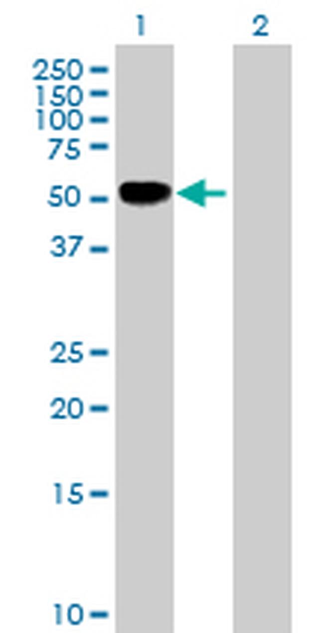 TNFRSF11B Antibody in Western Blot (WB)