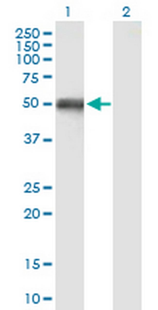 OXCT1 Antibody in Western Blot (WB)